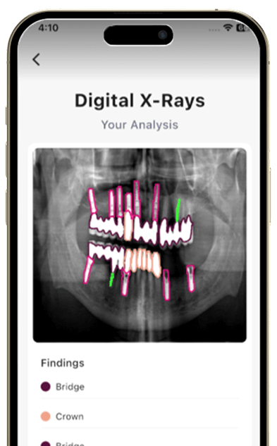 AI X-ray Analysis