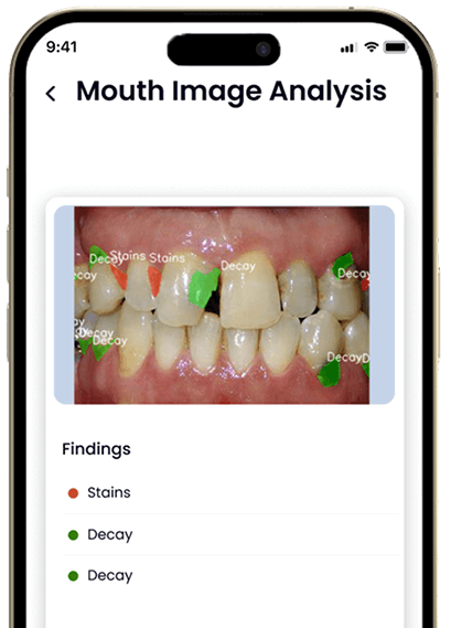 AI-Powered Mouth Image Insights